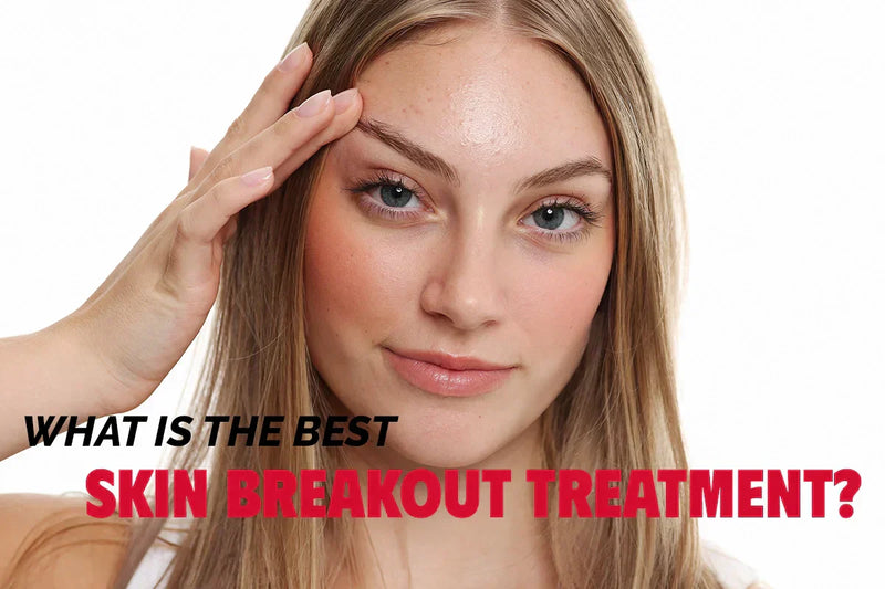 What Is the Best Skin Breakout Treatment? Expert-Recommended Solutions That Work
