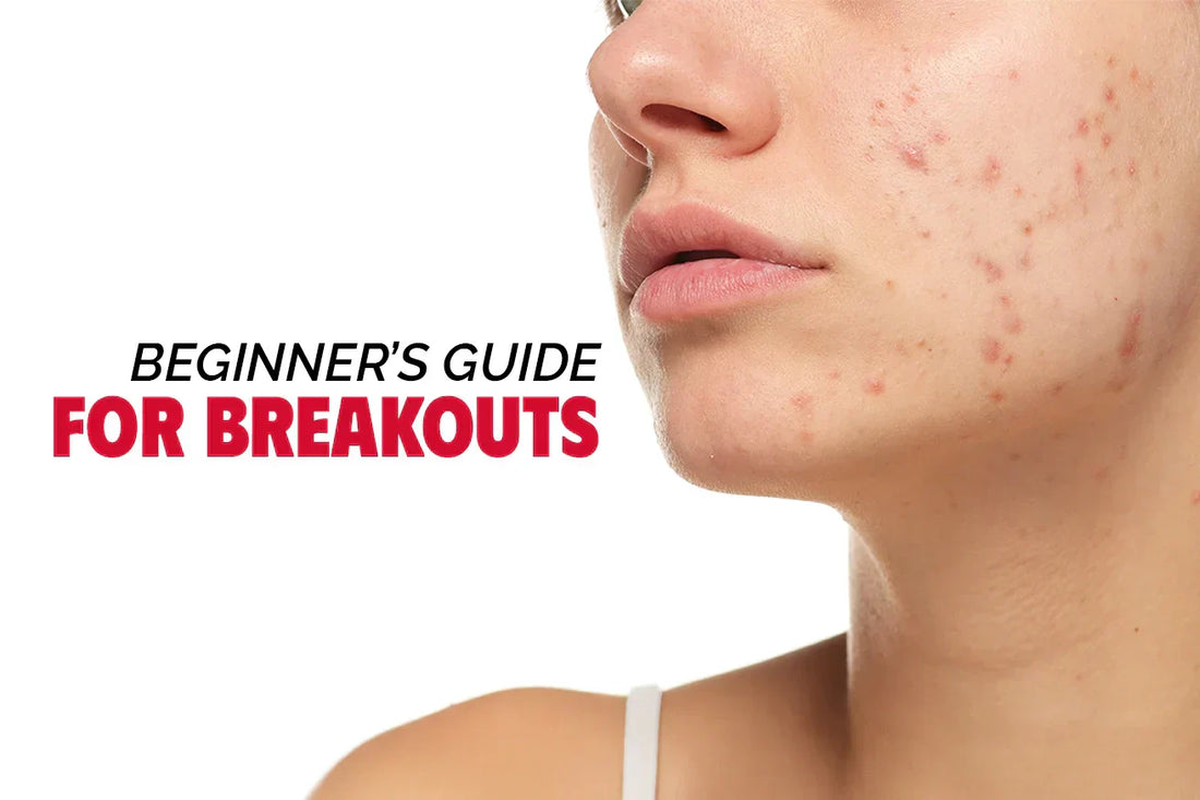 Your Beginner’s Guide to Skincare for Breakouts