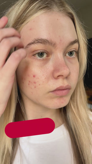 Salvarity skincare video ad