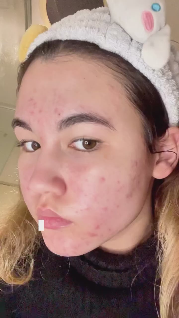 xia skincare video testimonial